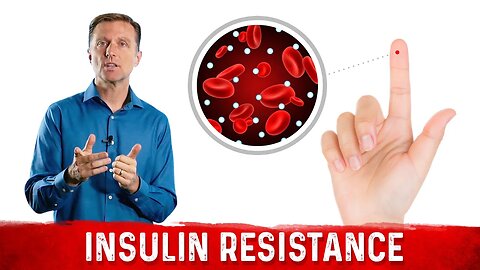 Understanding Insulin Resistance & What You Can Do About It – Dr.Berg