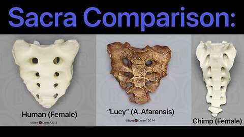 Is The “Lucy” (AL 288-1) Conglomeration a Fraud? | “Lucy’s” Human Appearing Sacrum {9-14-22}