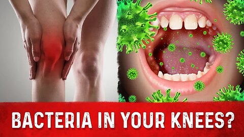 Knee Arthritis & Your Mouth Bacteria – Arthritis Knee Pain Relief – Dr.Berg