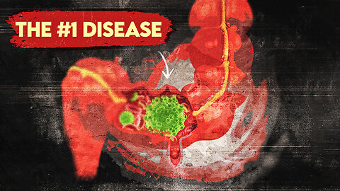 The #1 Disease More Common than Heart Disease and Cancer