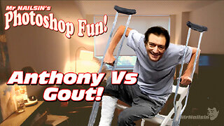 The Nailsin Ratings: Anthony Vs Gout!