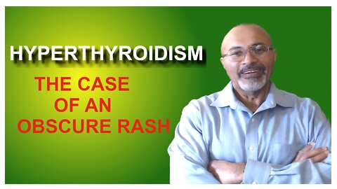 Hyperthyroidism and Rashes