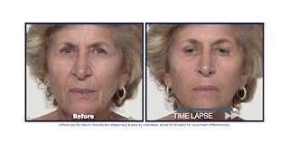 See what Plexaderm can do for you because the results are real