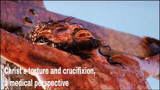 Christ's torture and crucifixion, a medical perspective