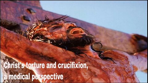 Christ's torture and crucifixion, a medical perspective