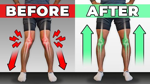 How To Unf-ck Your Knees in 10 Minutes_Day (CORRECTIVE ROUTINE)
