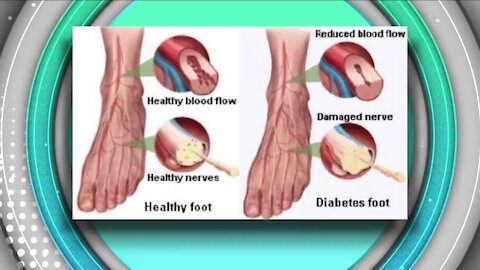 Front Range Medical Center // Peripheral Neuropathy Help