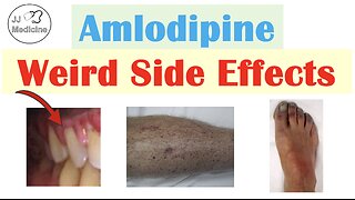 Amlodipine Weird Side Effects (Skin, Gastrointestinal, Psychological)