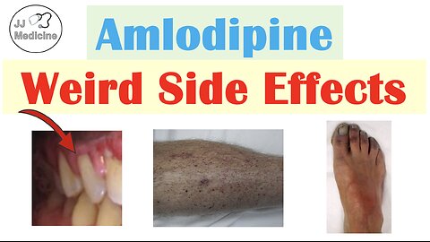 Amlodipine Weird Side Effects (Skin, Gastrointestinal, Psychological)