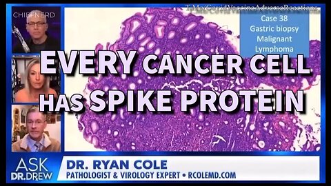 Every Cancer cell has spike protein in it.