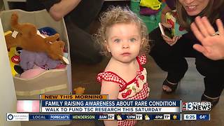 Family raising awareness about rare condition