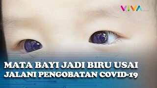 Mata Bayi Berubah Jadi Biru Usai Jalani Pengobatan COVID-19, Kok Bisa?