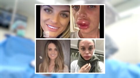 Botox and Fillers Gone Wrong!! | Dr. Daniel Barrett Discusses Botched Injectables Gone Wrong