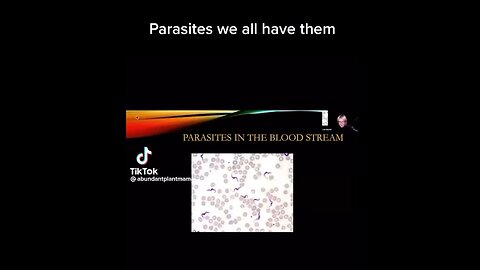 Everyone Has Parasites & Should Take Ivermectin Or Fenbendazole Two Weeks Per Year