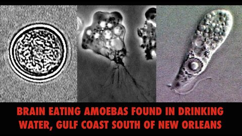 Gulf Coast in Big Trouble, Brain Eating Amoebas in Water, Toxic Algae Blooms, Hurricane on Way