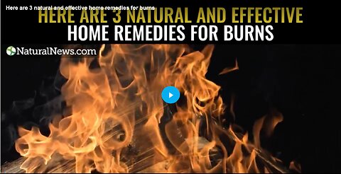 Here are 3 natural and effective home remedies for burns