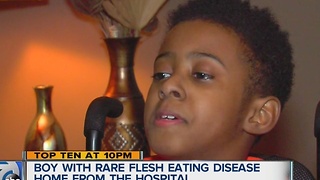 Detroit boy diagnosed with flesh-eating disease back home after amputation, months in the hospital