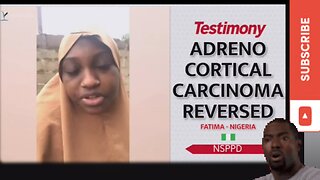 NSPPD FIRE THERAPY AND SPIRITUAL THERAPY TESTIMONY ADRENO CORTICAL CARCINOMA REVERSED