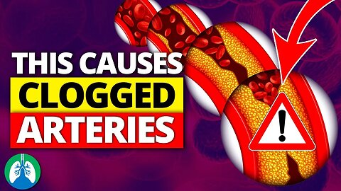 ❣️THIS is the #1 Hidden Cause of Clogged Arteries