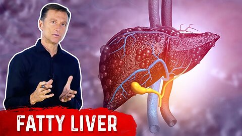 Why Does a Fatty Liver Have No Symptoms? – NAFLD (Non Alcoholic Fatty Liver Disease) by Dr.Berg