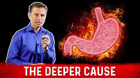 The Real Causes of Acid Reflux, Heartburn & GERD – Dr.Berg