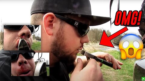 Fishing Angler Rips 2 Fishing Hooks From His Lip With Pliers
