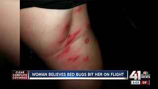 Woman says she was bitten by bugs during flight