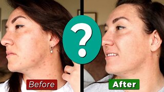 GEOLOGIE skincare review for WOMEN || Does it REALLY work? (UNSPONSORED)