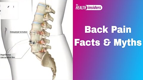 Back Pain Facts and Myths | What is the cure of Back pain