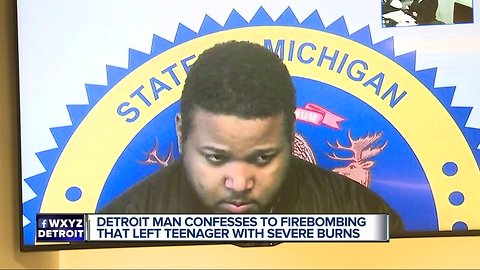 Detroit man confesses to firebombing that left teenager with severe burns