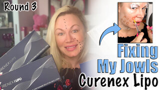 Fixing my Jowls with Curenex Lipo, Round 3 from Acecosm.com | Code Jessica10 Saves you Money!
