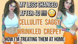 DIY Summer Leg Treatments / Cellulite Dimples Loose Sagging Wrinkled / Products Discount Promo Code