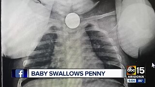Mesa mother warns parents to seek help if your child swallows a small object