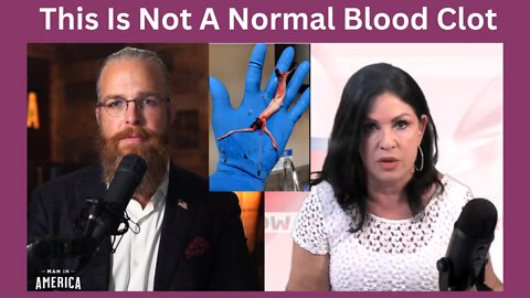 Dr. Jane Ruby: Regular Blood Clot VS. The Blood Clots Found In Vaccinated Cadavers