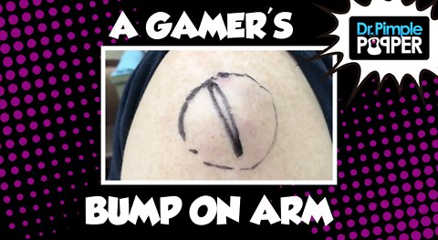 A Gamer's Bump