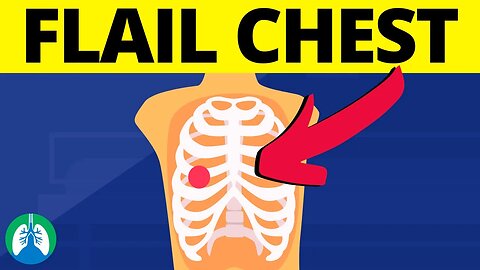 Flail Chest (Medical Definition) | Chest Trauma