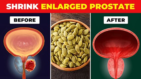 Top Foods to Shrink an Enlarged Prostate | prostate treatment