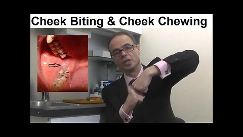 Problems Associated With Cheek Biting, Cheek Chewing or Morsicatio Buccarum by Dr Mike Mew