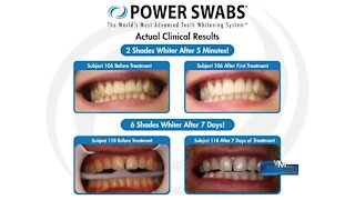 Get your teeth whiter with Power Swabs