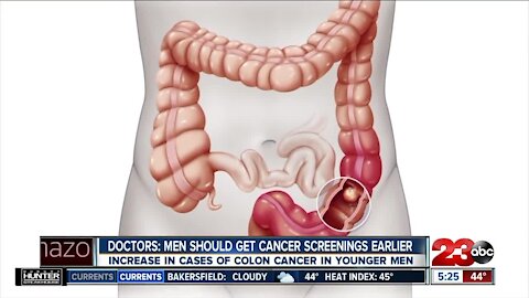 Doctors say men should get cancer screenings earlier, increase in cases of colon cancer in younger men