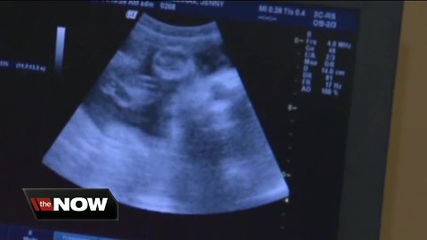 New Florida bill would ban abortions after fetal heartbeat is detected