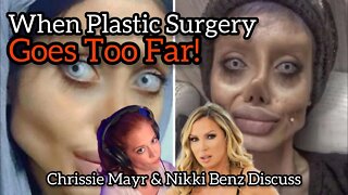 Plastic Surgery Going Too Far With No Way Back?! Nikki Benz Explains on Chrissie Mayr Podcast