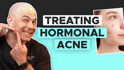 How To Overcome Hormonal Acne | Skin Care Tips