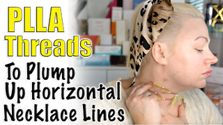 PLLA Threads to Plump Up Horizontal Necklace Lines from Acecosm | Code Jessica10 Saves you Money!