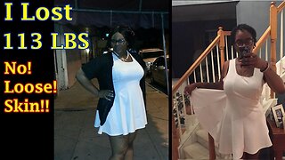 I lost 113LBS Water Fasting And My PCOS Is Going Away!!