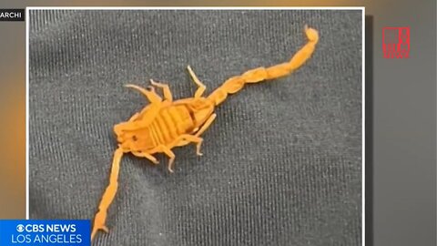 Scorpion Attacks Testicles Of Man At A Las Vegas Hotel