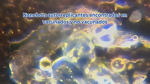 Nanobots autorreplicantes encontrados en vacunados y no vacunados