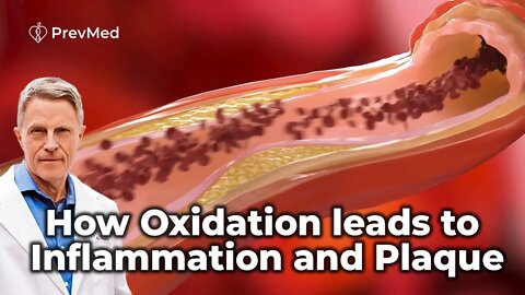 How Oxidation leads to Inflammation and Plaque