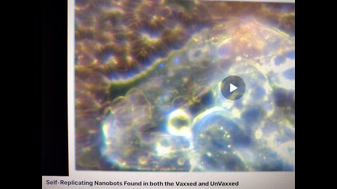 Self-Replicating Nanobots Found in both the Vaxxed and UnVaxxed (Reese Report - May 2024)