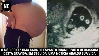 O médico fez uma cara de espanto quando viu o ultrassom desta grávida. Em seguida, uma notícia...